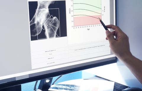 Bone density hip scan results on a medical display