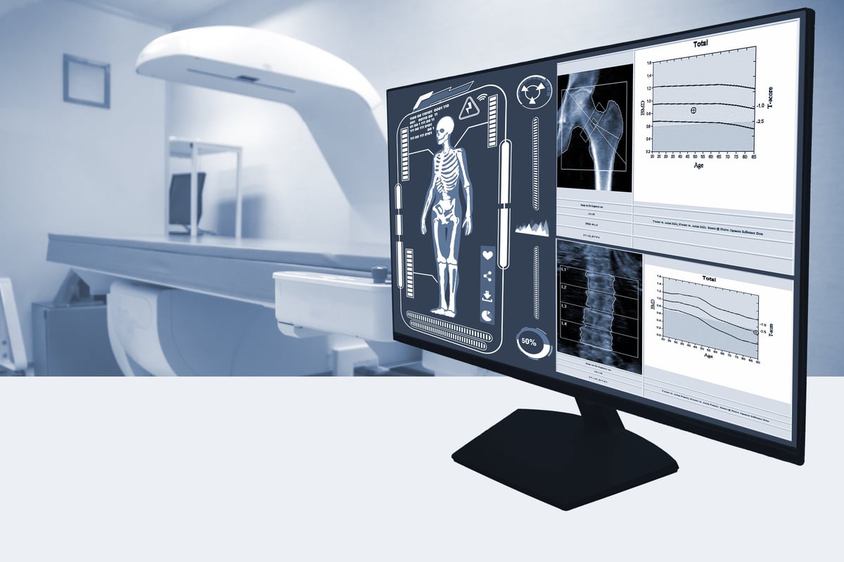 Close-up of whole-body bone density images being reviewed during a health consultation