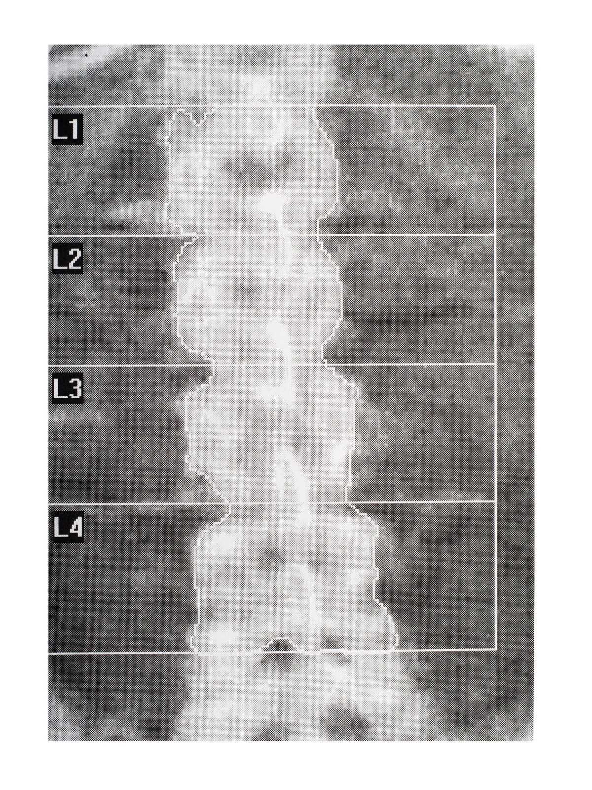 Medical imaging scan displayed on a lightbox during review