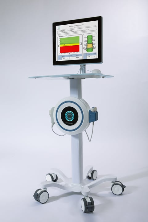 EchoLight REMS bone density scanner — a portable ultrasound-based diagnostic station on a wheeled cart