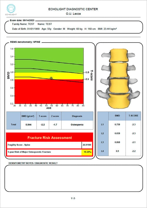 Sample REMS diagnostic report showing spine bone density results, T-score, and 5-year fracture risk assessment