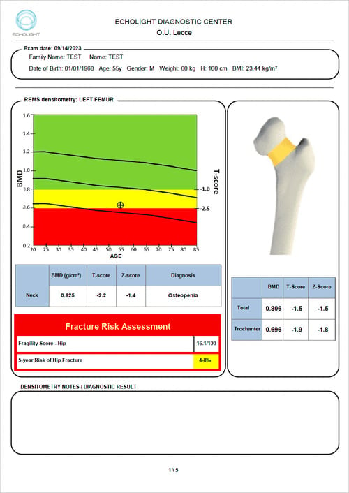Sample REMS diagnostic report showing hip and femur bone density results, T-score, and 5-year fracture risk assessment